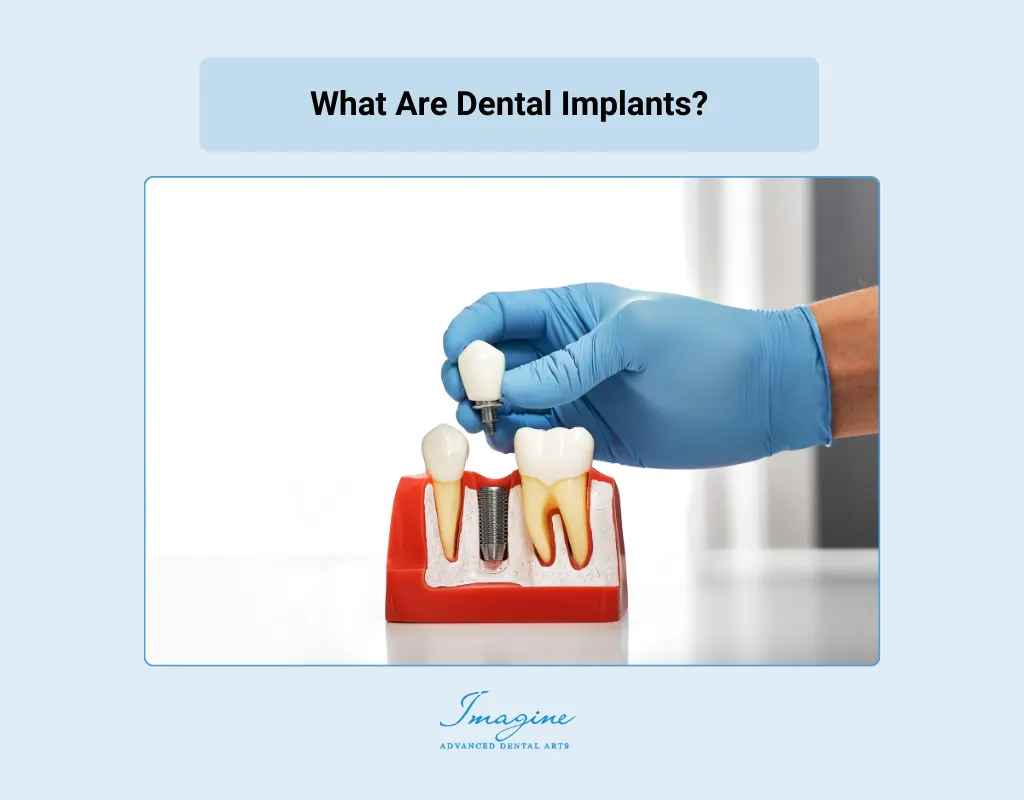 Dental implant model showing a replacement tooth root