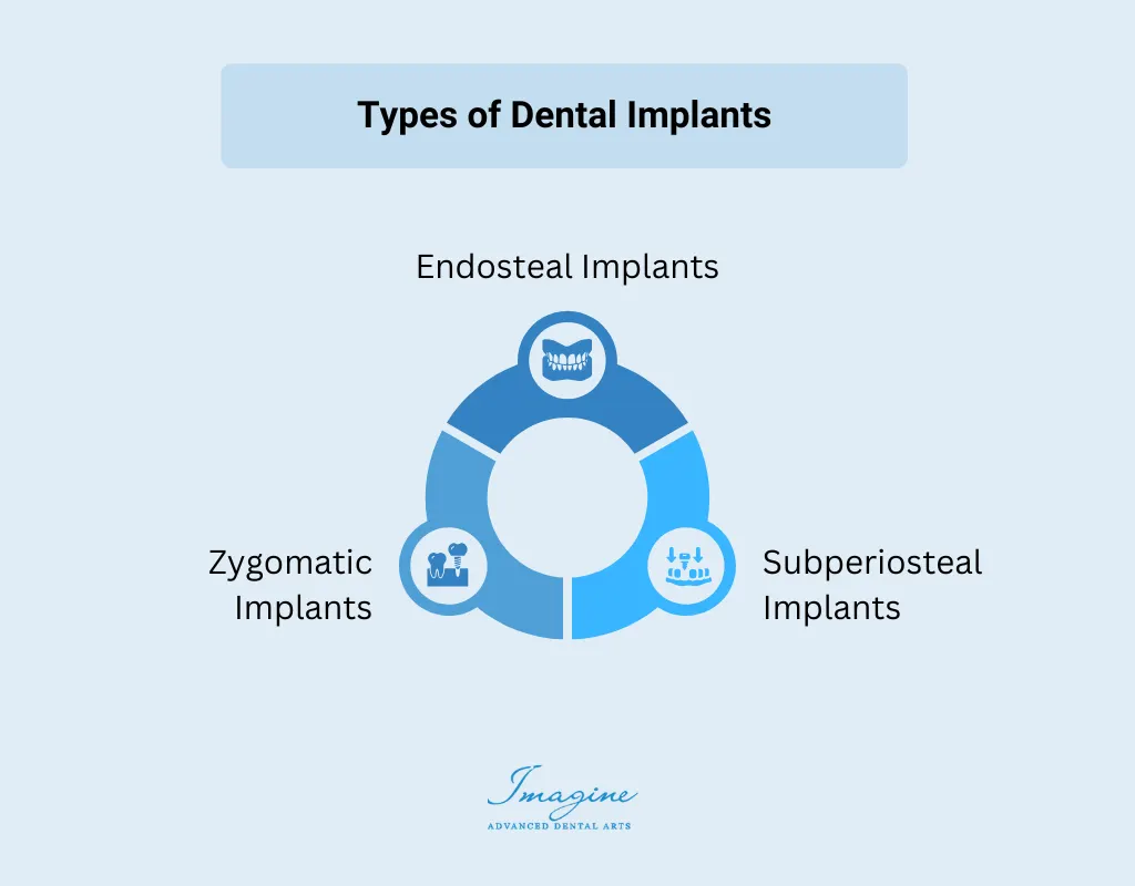 Dental implant restoration diagram