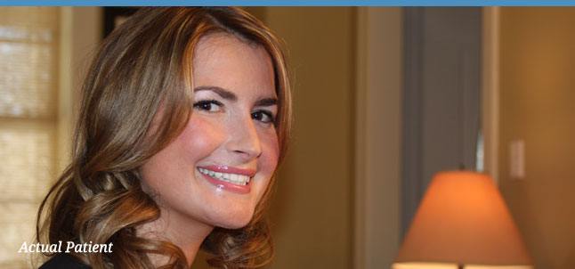Facial rejuvenation and cosmetic dentistry results