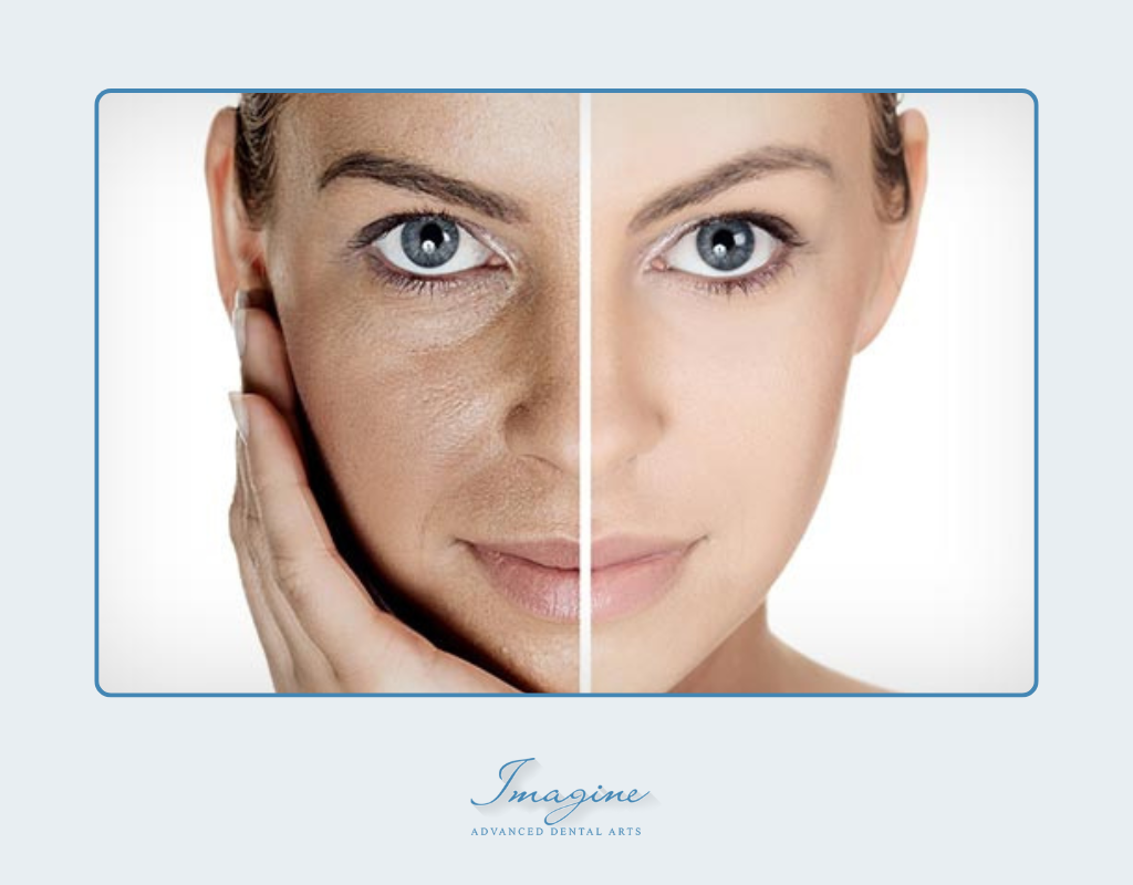 BOTOX Cosmetic and Dysport