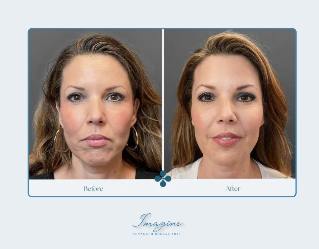 What Is Skin Rejuvenation and Resurfacing