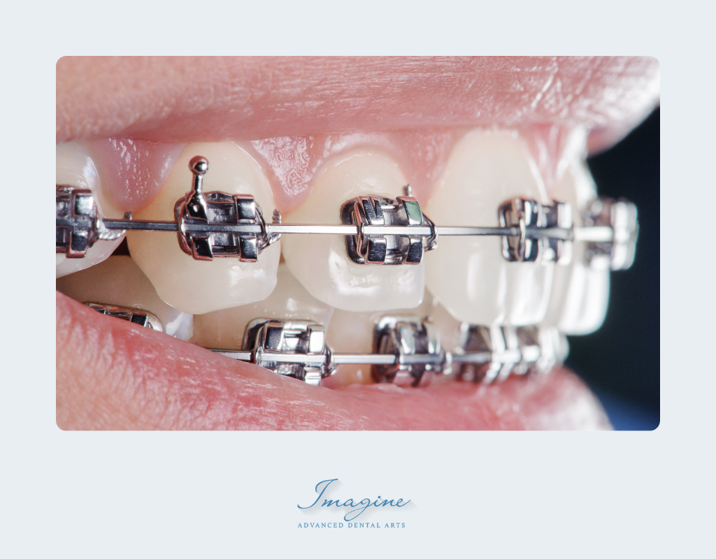What is Orthodontics
