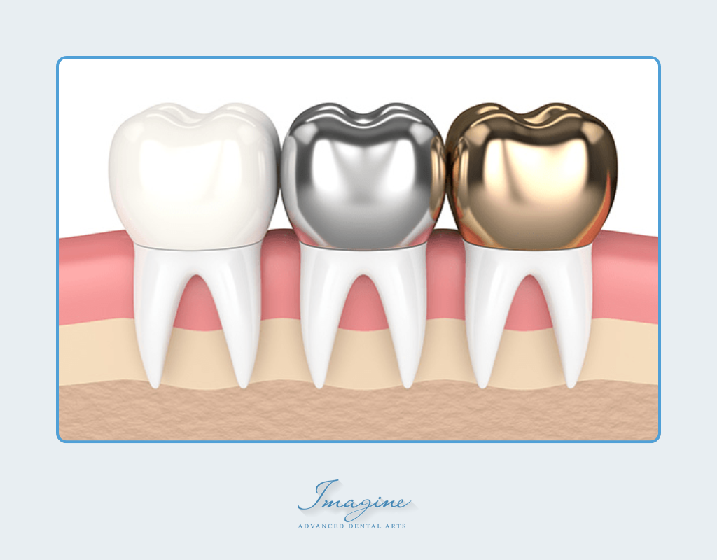Porcelain and zirconia dental crowns