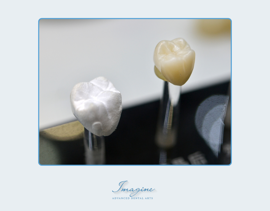 Porcelain crowns matching natural teeth