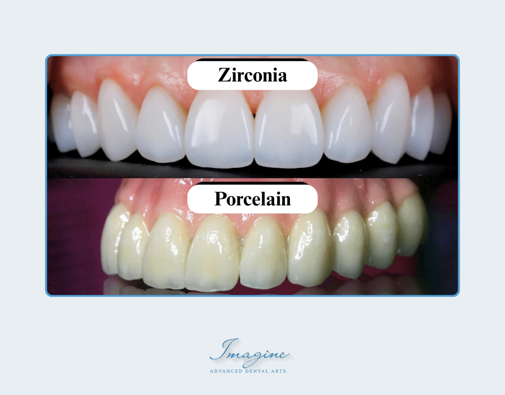 Zirconium crowns versus porcelain crowns