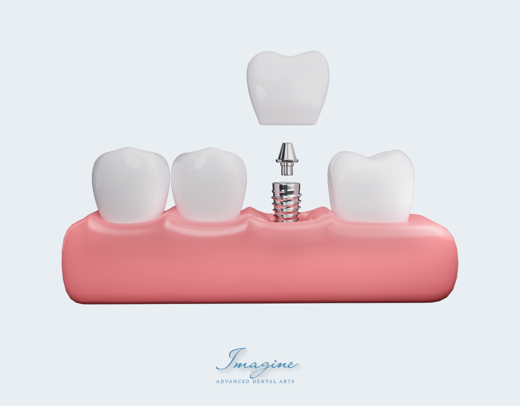 Caring for porcelain and zirconia dental crowns