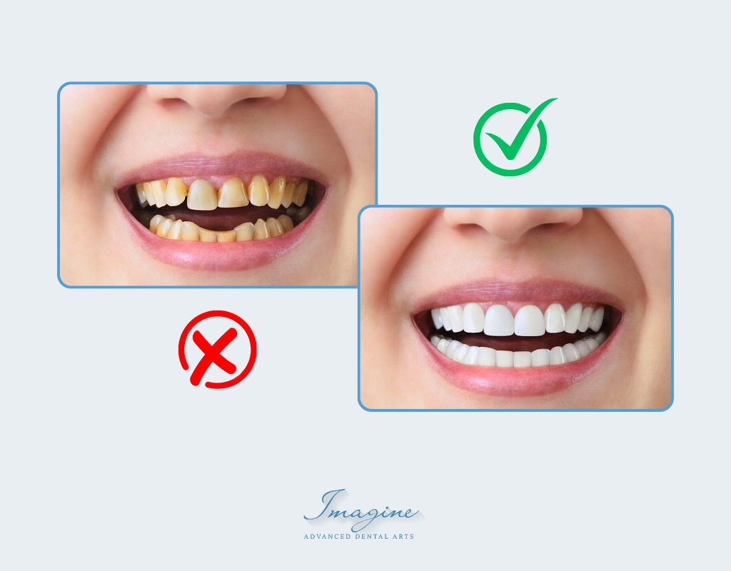 Choosing zirconia or porcelain dental crowns