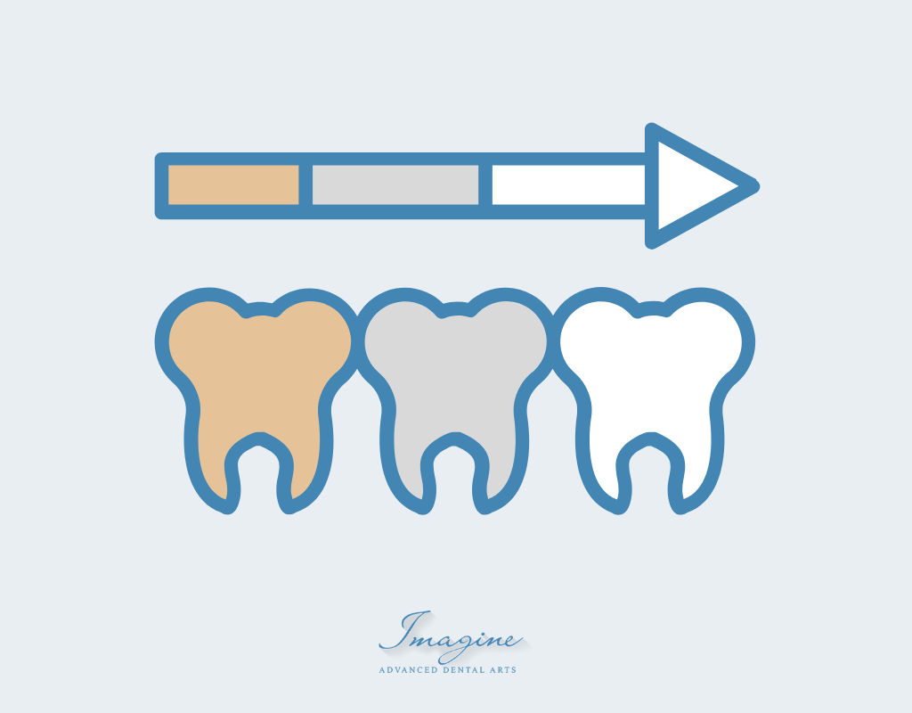 Safe professional teeth whitening results